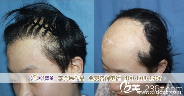 　　岳先生今年才28歲，事業(yè)也小有成績(jī)，但遲遲沒(méi)有愛(ài)情降臨，