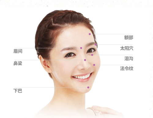 愛貝芙玻尿酸注射部位