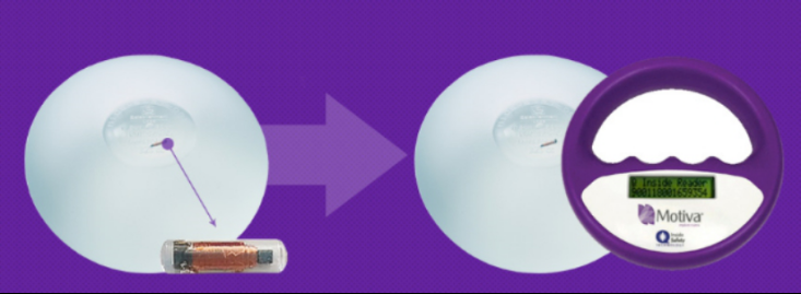  麥恩醫(yī)院motiva（魔滴）假體