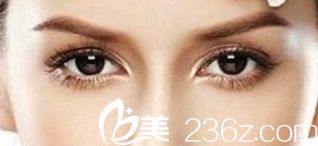 沒(méi)有黑眼圈的眼睛樣子