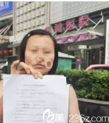 自體脂肪填充面部后凹凸不平