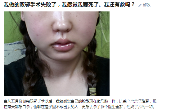 雙鄂修復(fù)手術(shù)—韓國id醫(yī)院—樸相薰院長雙鄂修復(fù)手術(shù)