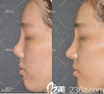 魏亨坤院長(zhǎng)的手術(shù)案例之一