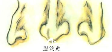 鷹鉤鼻的典型特征