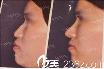 will醫(yī)院魏亨坤院長手術(shù)案例展示