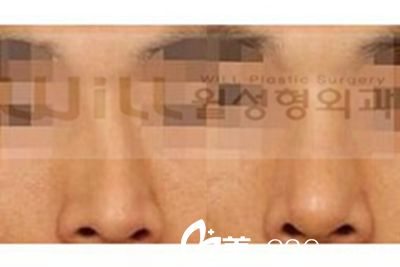 will醫(yī)院魏亨坤院長的手術(shù)