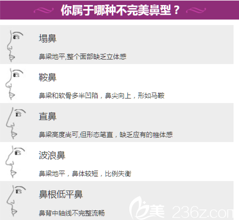 韓國原辰整形外科鼻綜合優(yōu)惠活動價7折