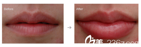 北京米蘭柏羽麗都整形美容醫(yī)院案例圖