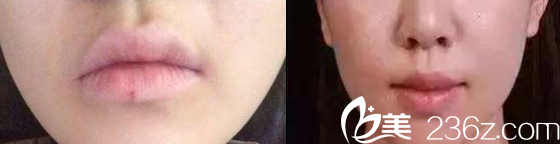 案例術(shù)前術(shù)后對(duì)比圖