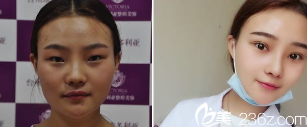 常文彥醫(yī)生的鼻綜合<span style=