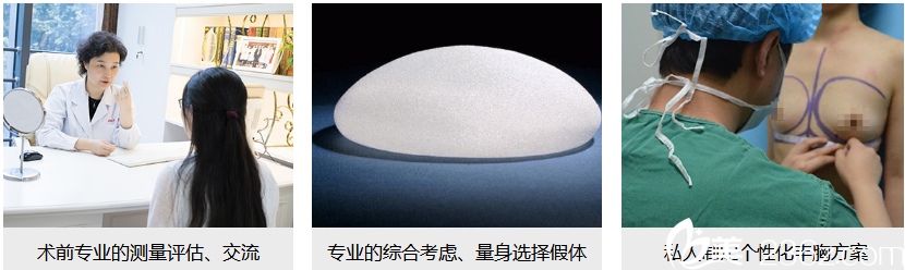 江蘇施爾美隆胸有保障 江蘇施爾美隆胸有保障