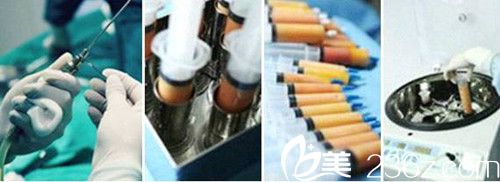 鮮活提煉脂肪技術(shù) 鮮活提煉脂肪技術(shù)