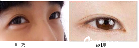 北京米蘭柏羽麗都整形醫(yī)院案例圖