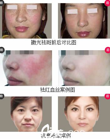 徐麗珍主任整形案例圖 徐麗珍主任整形案例圖