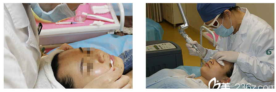 湛美何慧霞祛痣過(guò)程圖 湛美何慧霞祛痣過(guò)程圖