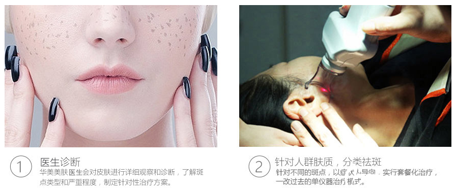 湛美何慧霞老年斑治療過(guò)程 湛美何慧霞老年斑治療過(guò)程