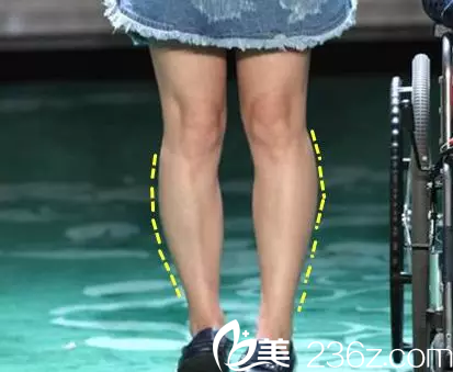 瘦臉除皺瘦小腿—韓國(guó)365mc醫(yī)院