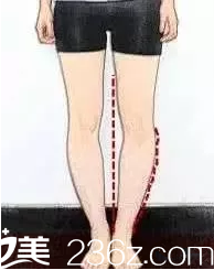 韓國(guó)365mc醫(yī)院——瘦臉除皺瘦小腿