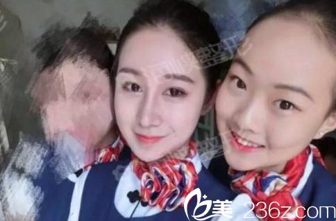 濟南海峽醫(yī)院假體隆鼻手術(shù)價格