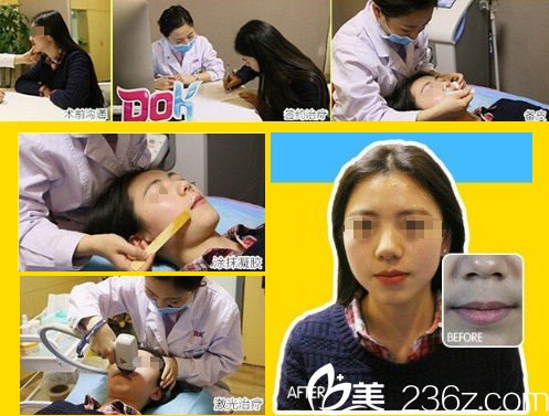 20171103_1509670540309276.png blob.png