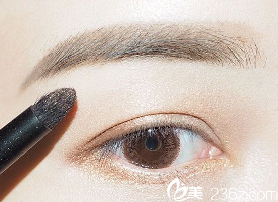 韓國(guó)will醫(yī)院——雙眼皮手術(shù)改善眼部形態(tài)