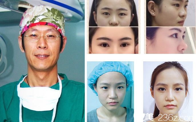 周長兵醫(yī)生的眼鼻整形案例 周長兵醫(yī)生的眼鼻整形案例