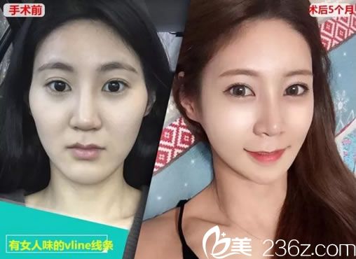 成功擁有女人味的Vline線條