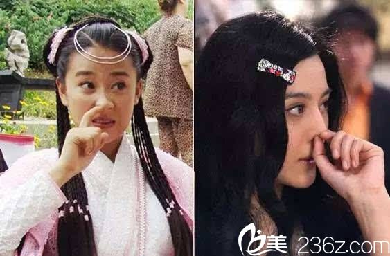 隆鼻后能挖鼻屎嗎韓國will醫(yī)院魏亨坤院長為您解答