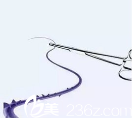 面部線雕所采用的蛋白線