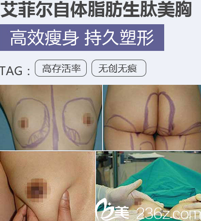 20171110_1510285095561972.png blob.png