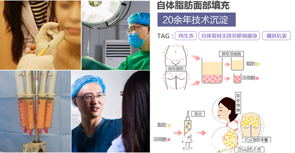 20171110_1510293787785669.png blob.png