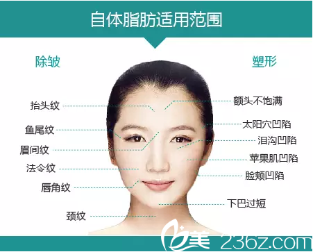 自體脂肪填充形成少女臉