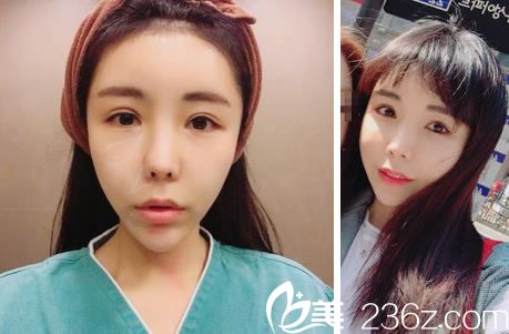 具賢國院長的抗衰老案例 具賢國院長的抗衰老案例