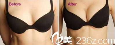 紫潔儷方(北京)醫(yī)療美容診所案例 紫潔儷方(北京)醫(yī)療美容診所案例