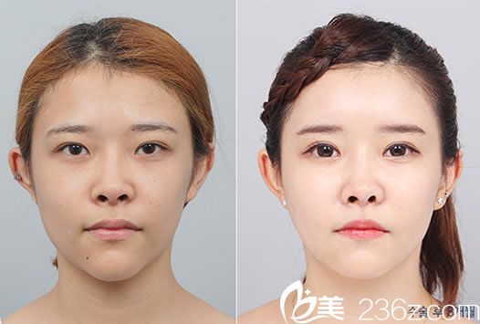 高一仙院長(zhǎng)的皮膚抗衰案例圖