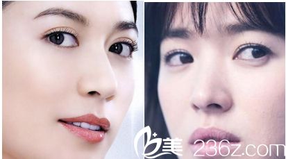 青島壹美做雙眼皮怎么樣？