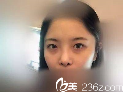 南京維多利亞做整形效果好嗎