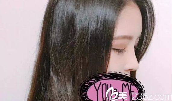 南京維多利亞隆鼻開(kāi)眼角術(shù)后2周