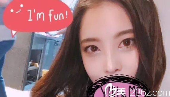 南京維多利亞開(kāi)眼角隆鼻術(shù)后三個(gè)月