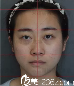 北京米揚(yáng)麗格對求美者面部分析 北京米揚(yáng)麗格對求美者面部分析