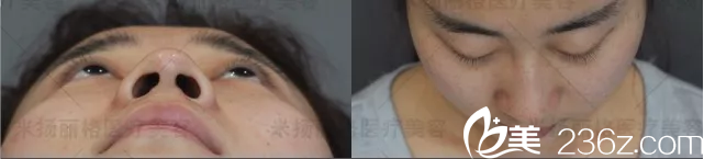 北京米揚(yáng)麗格真人案例分析 北京米揚(yáng)麗格真人案例分析