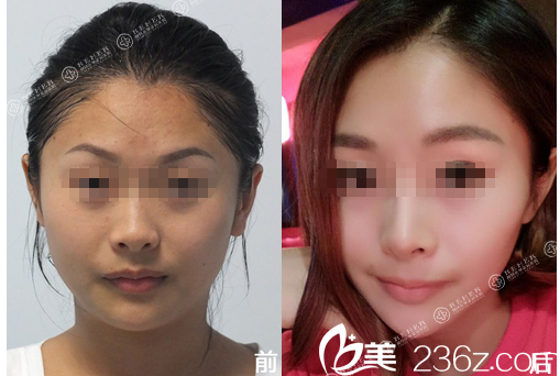 20171115_1510732488114414.png image.png