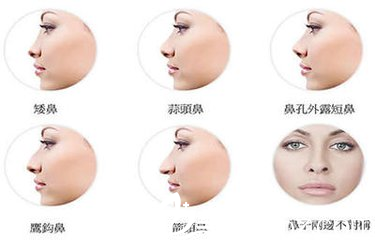 隆鼻只是單純改變鼻子的形態(tài)？