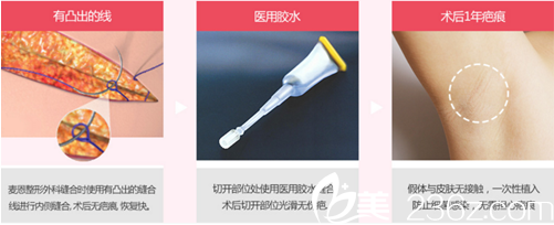 韓國(guó)麥恩醫(yī)院縫合方式不需要拆線