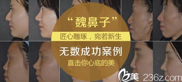 韓國will魏亨坤手術(shù)案例