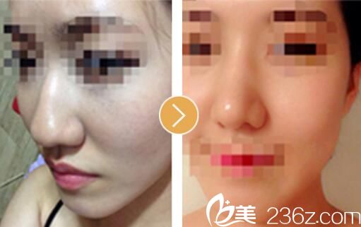 韓國will醫(yī)院魏亨坤案例