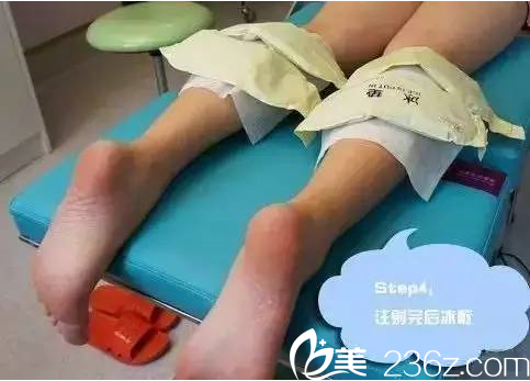 瘦腿注射后冰敷