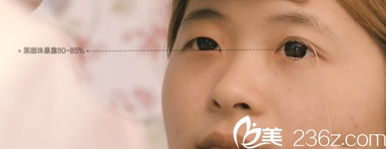 沈陽(yáng)名流醫(yī)院做雙眼皮好不好?