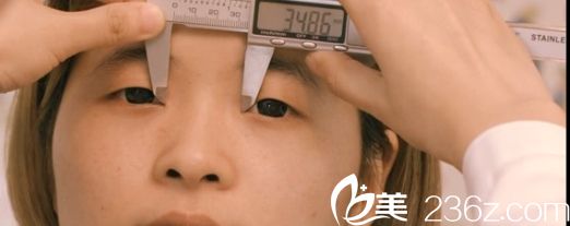 沈陽(yáng)名流醫(yī)院雙眼皮術(shù)前設(shè)計(jì)