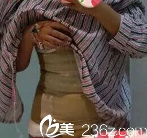 我在沈陽(yáng)茗湲做腰腹吸脂手術(shù)后2天.jpg 我在沈陽(yáng)茗湲做腰腹吸脂手術(shù)后2天.jpg